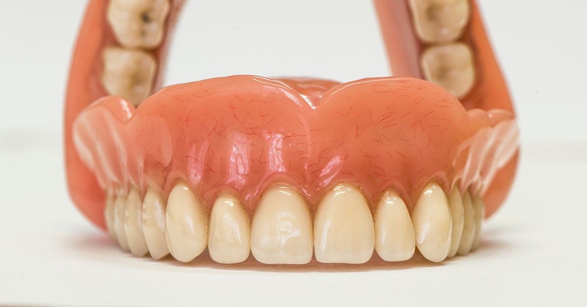 Wax Bite For Dentures Scottown OH 45678